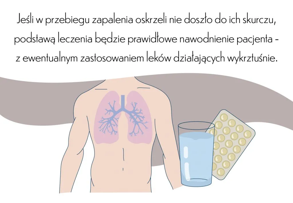 Zapalenie oskrzeli por&oacute;wnanie zdrowych i chorych oskrzeli