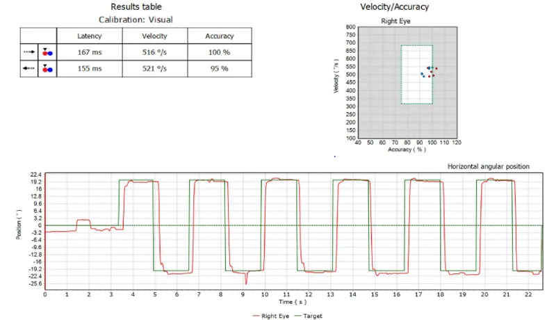 badanie VNG sprzęt wykres motylkowy