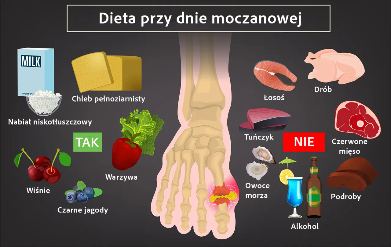 Przyczyny wysokiego kwasu moczowego, styl życia i dieta