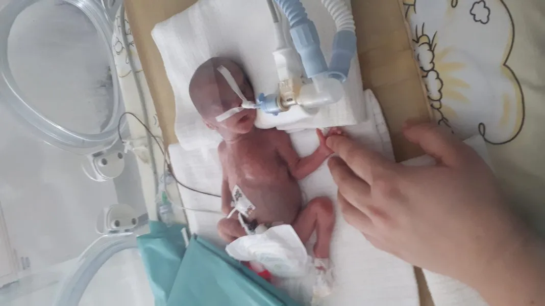 noworodek 22 tydzień ciąży wygląd