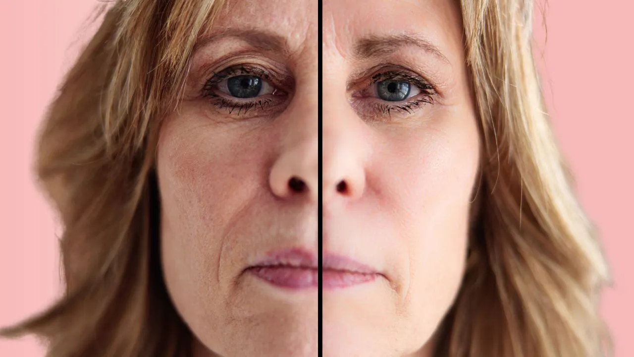 skóra dojrzała zmiany wiek utrata kolagenu elastyny