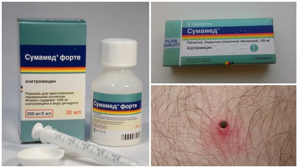 Zdjęcie Jak długo brać antybiotyk po ugryzieniu kleszcza? Kluczowe informacje i zalecenia