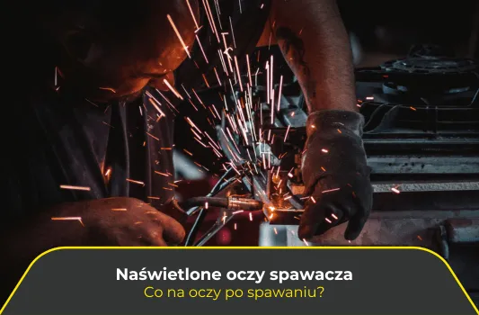 Zdjęcie Naświetlone oczy od spawania co robić: skuteczne metody ulgi i ochrony