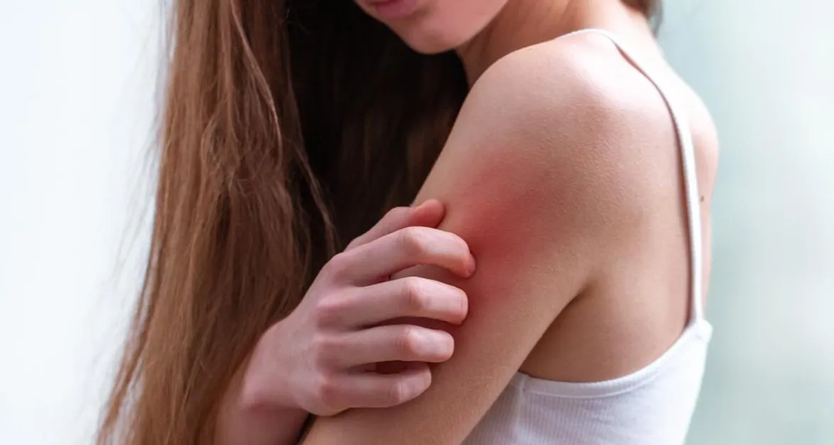 Zdjęcie Jakie leki na półpaśca bez recepty skutecznie złagodzą ból i objawy?