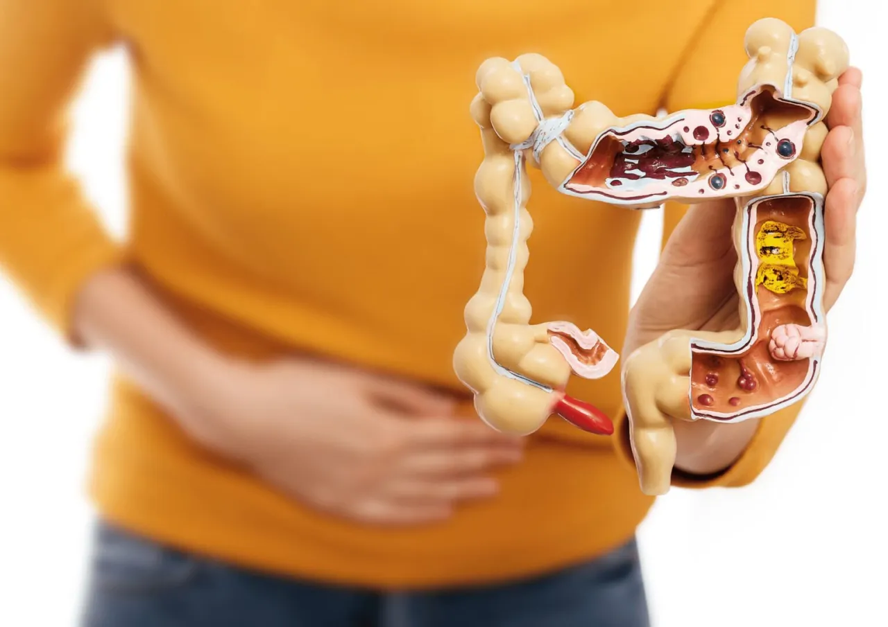 mechanizm wzdęć jelitowych