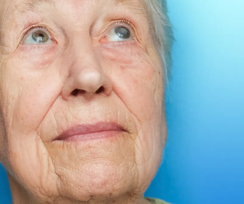 proces gojenia oka po operacji zaćmy