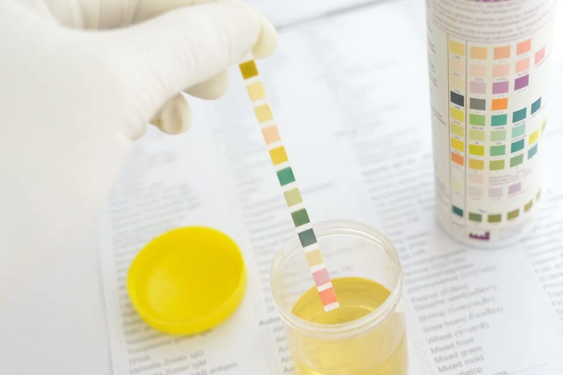 badanie ogólne moczu parametry, pasek testowy moczu