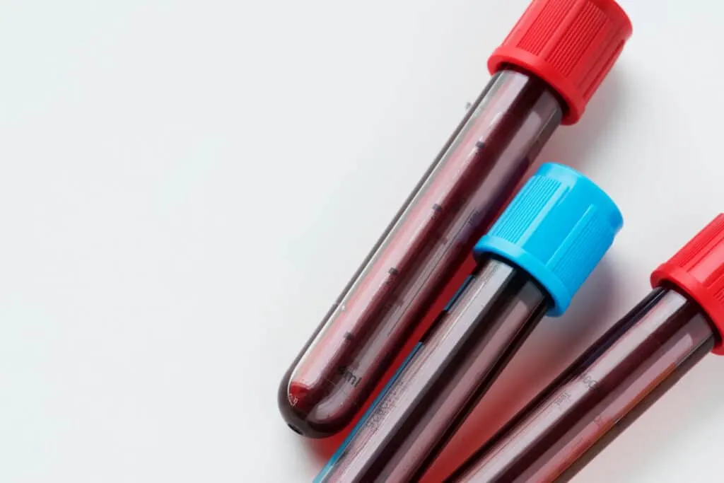 Zdjęcie Jakie badania robi się na trzustkę? Klucz do diagnozowania problemów zdrowotnych