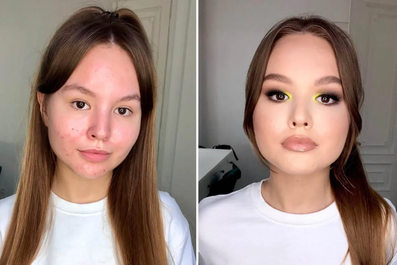 przygotowanie skóry pod makijaż cera trądzikowa