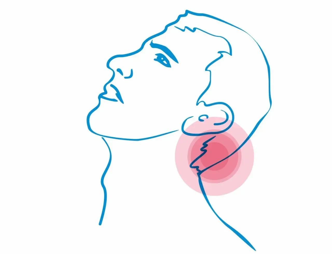 Linia rysunku przedstawia profil mężczyzny z zaczerwienionym obszarem wokół szyi, sugerującym ból głowy z tyłu.