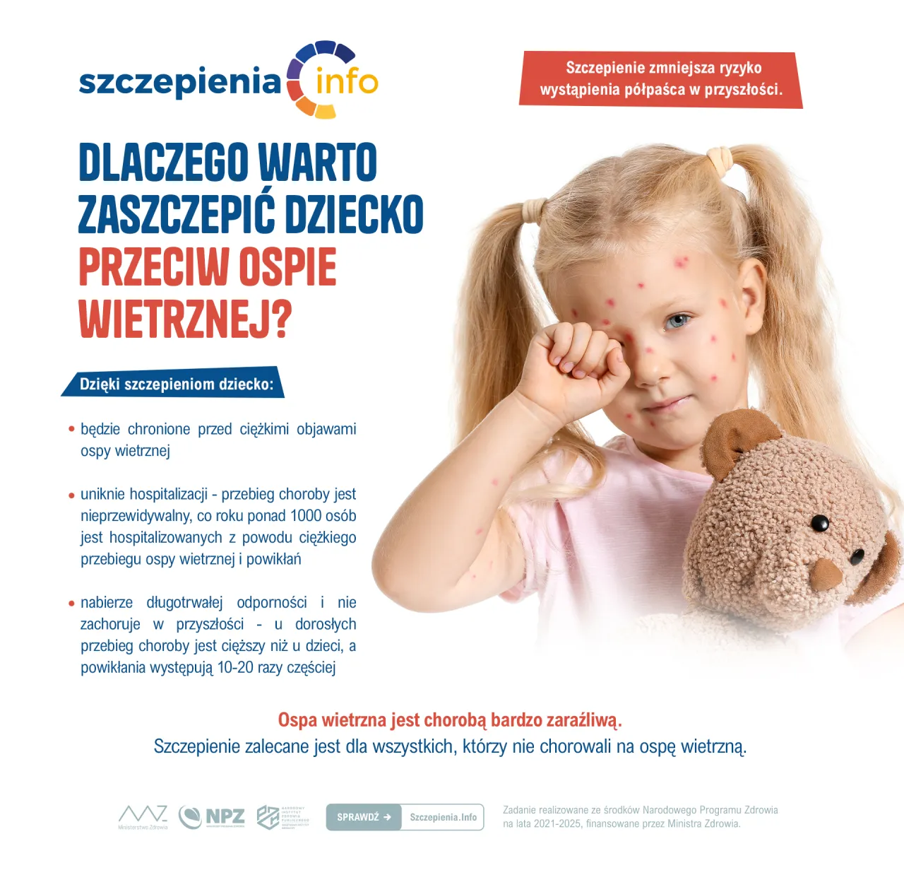 dziecko szczepienie ospa wietrzna