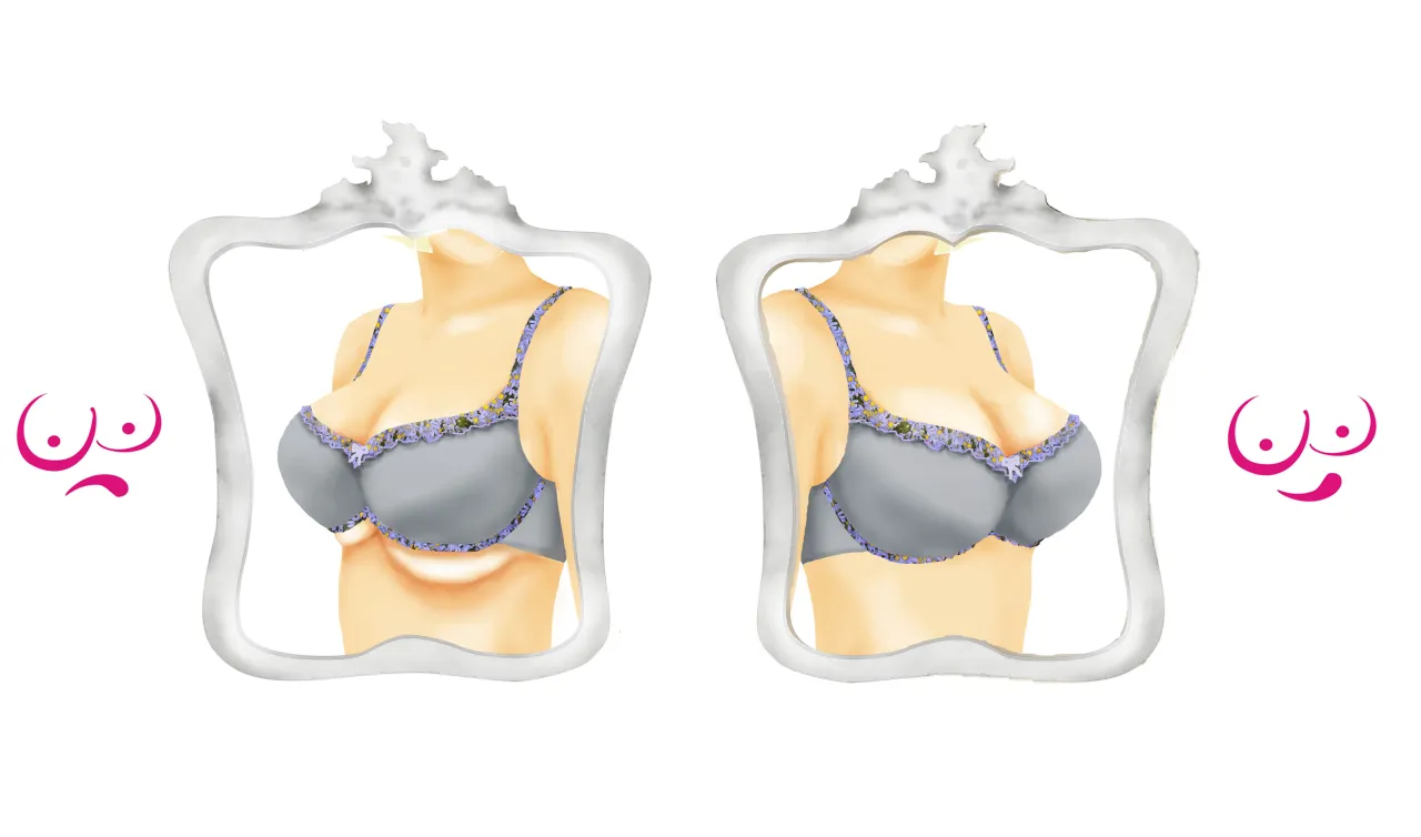 Dwa biusty w biustonoszu, jeden z widocznym fałdkiem, drugi gładki. Czy to zasługa fiszbin?