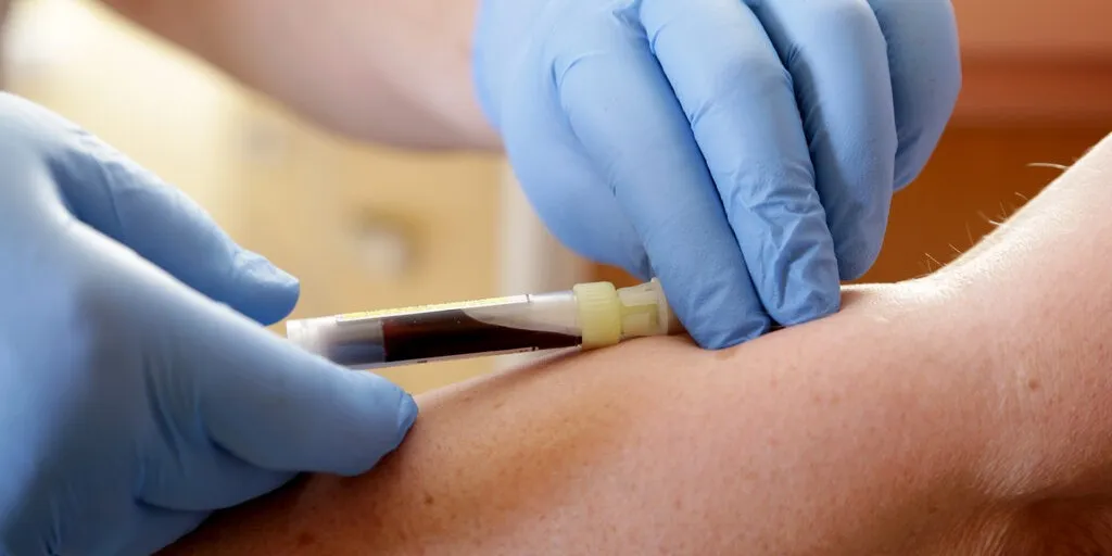 przyczyny podwyższonego mcv i mch infografika