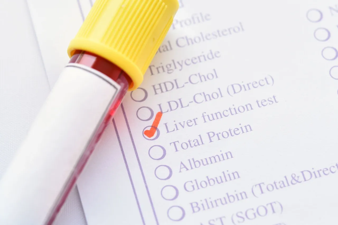 badanie krwi AST co to jest