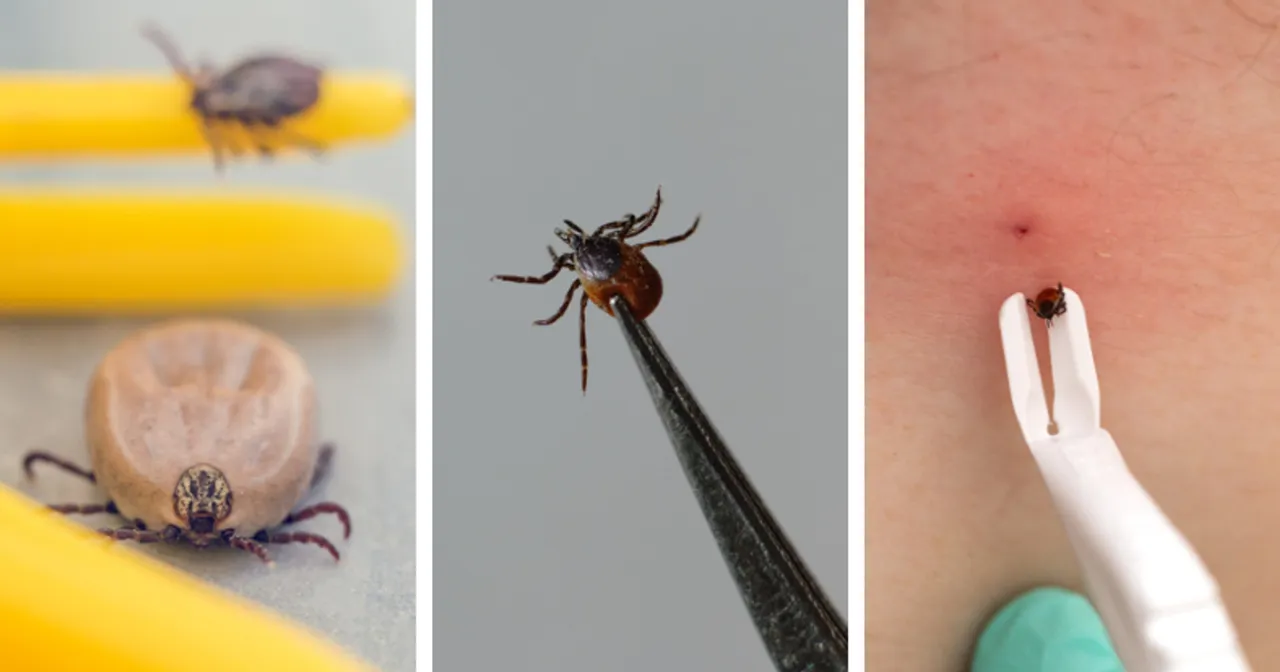 kleszcz na skórze człowieka