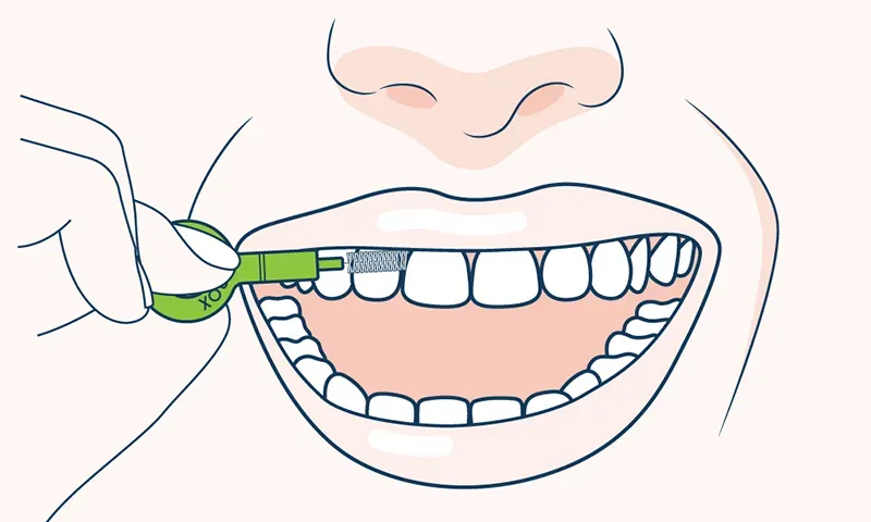 prawidłowa higiena jamy ustnej w ciąży szczoteczka nić