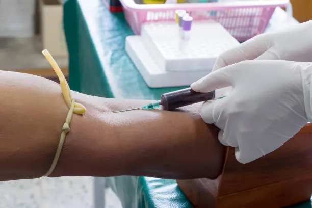 Kobieta pobierająca krew w laboratorium