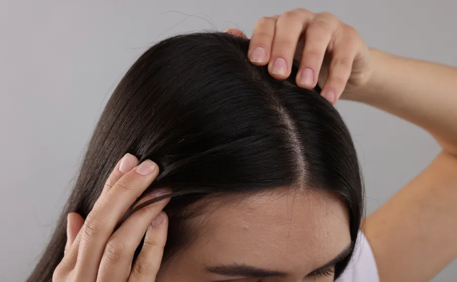 zdrowa skóra głowy i włosy