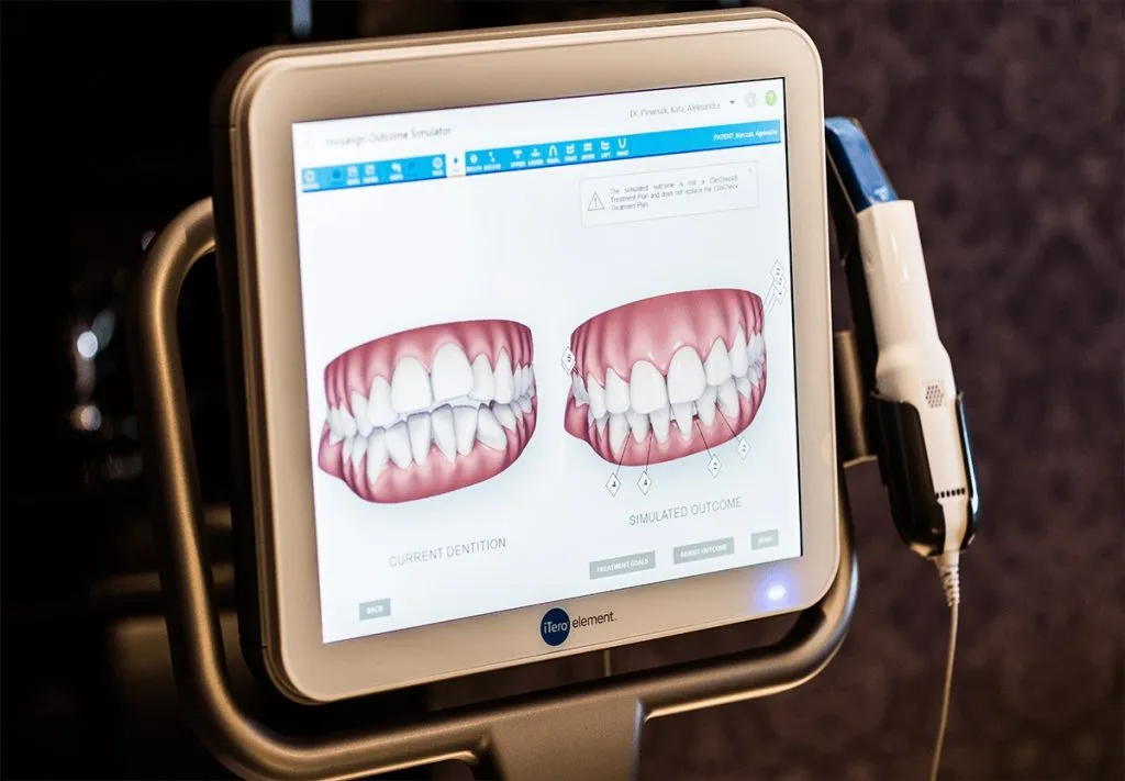 skaner wewnątrzustny stomatologia 3D