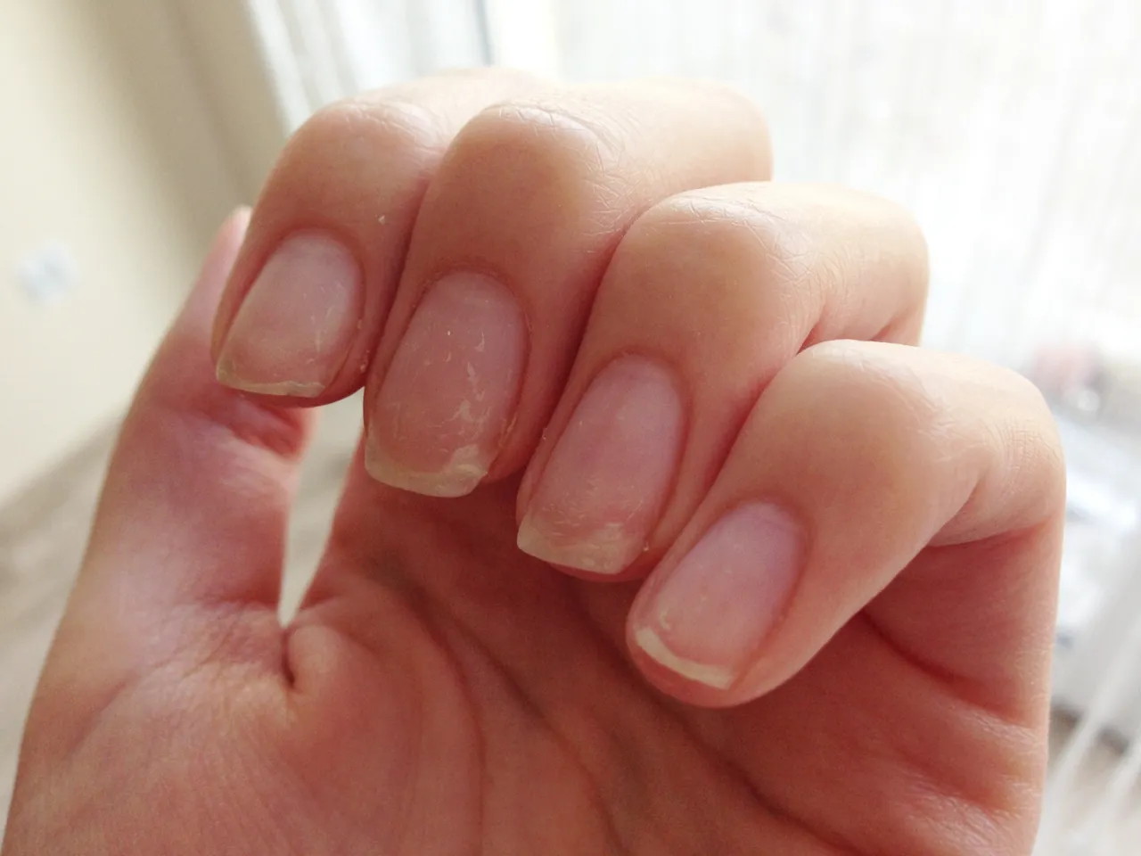 Uszkodzone paznokcie po żelu, zdrowe paznokcie po żelu