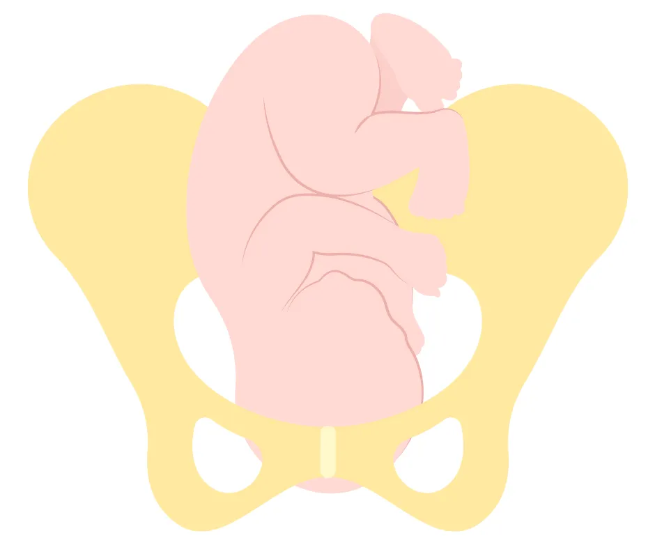 Ułożenie potylicowe tylne płodu w miednicy