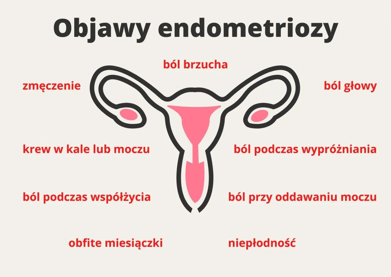 Zdjęcie Najczęstsze objawy endometriozy - jak rozpoznać chorobę bez opóźnień