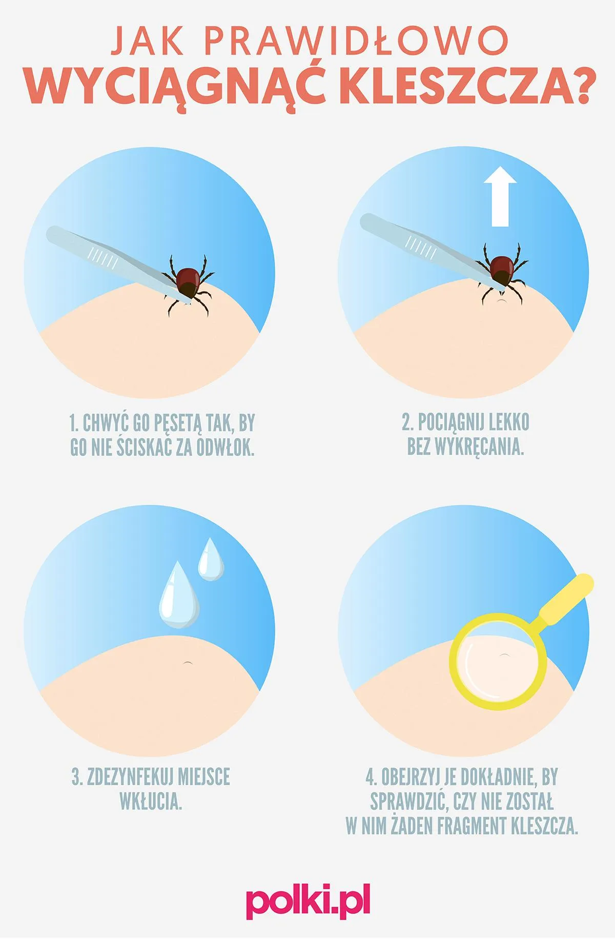 Zdjęcie Jak bezpiecznie usunąć głowę kleszcza i uniknąć groźnych konsekwencji