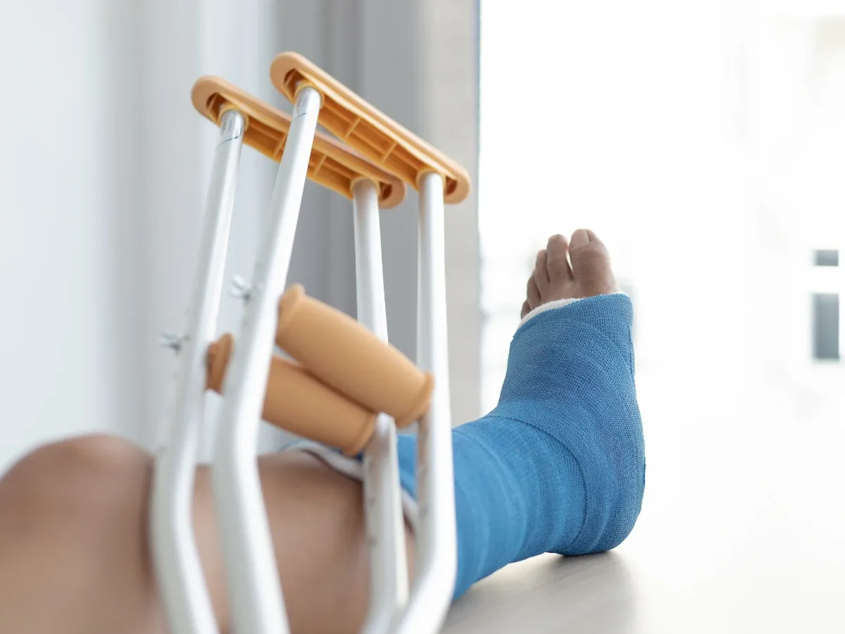 Zdjęcie Ile trwa rehabilitacja po złamaniu kostki bocznej? Fakty i wskazówki