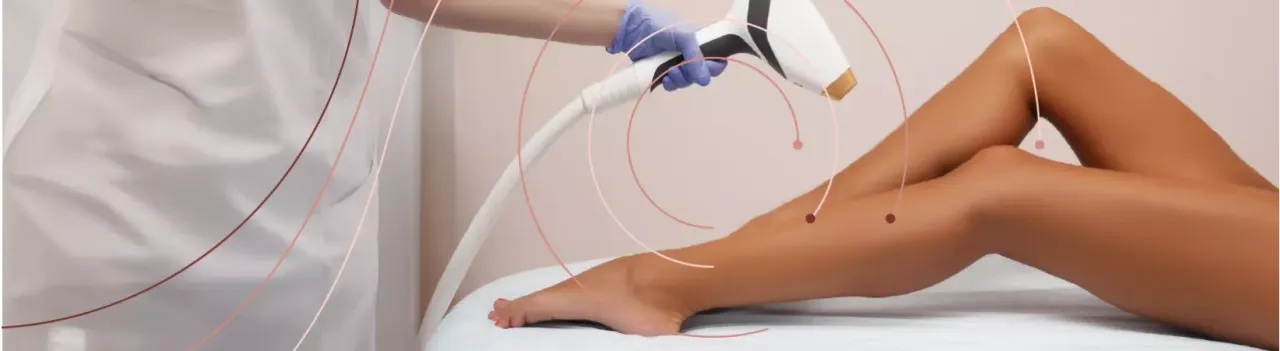 Czynniki wpływające na trwałość depilacji laserowej