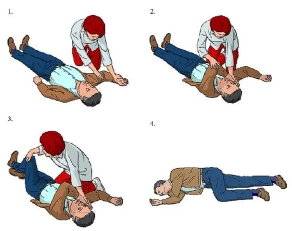 przykłady memów pozycja boczna ustalona