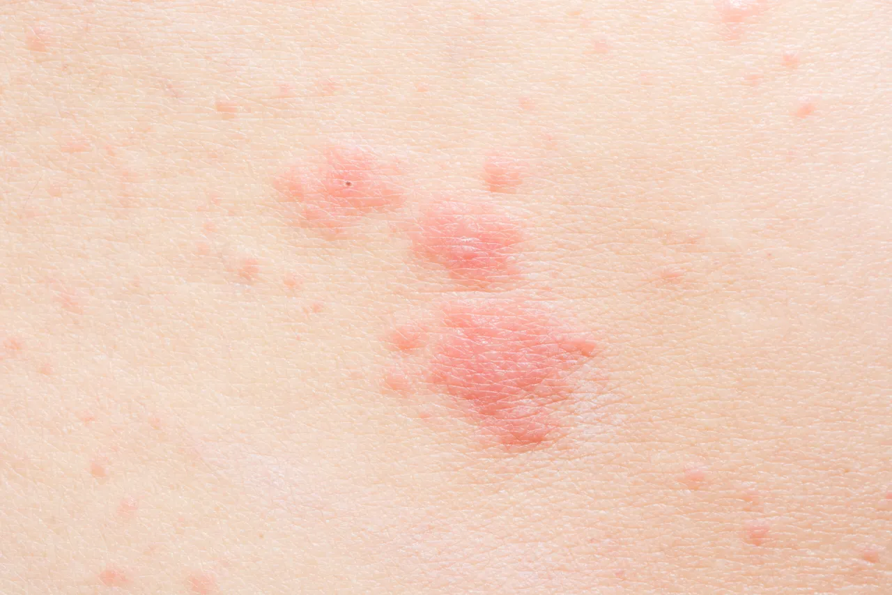 Poważne objawy po lekach