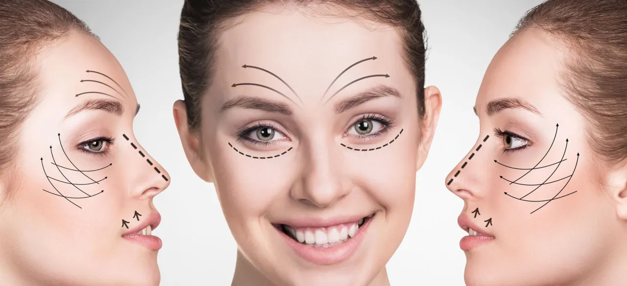 mapa iniekcji kwasu hialuronowego twarz