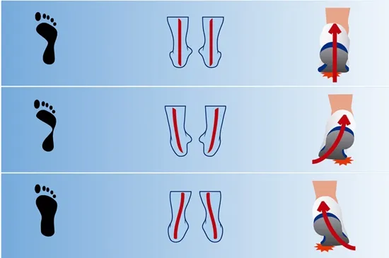 typy stóp pronacja supinacja neutralna
