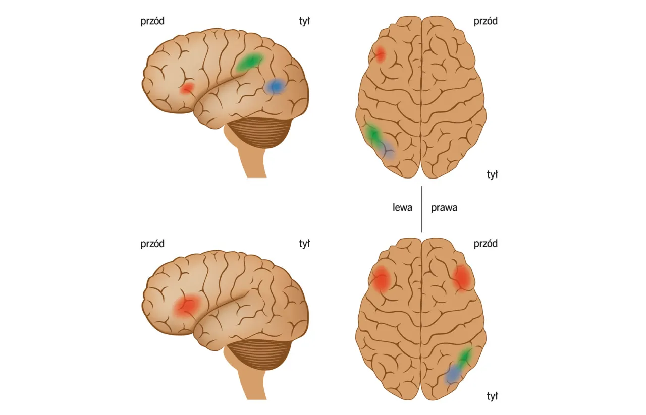 schemat m&oacute;zgu, obszary odpowiedzialne za czytanie, neurobiologiczne podstawy dysleksji