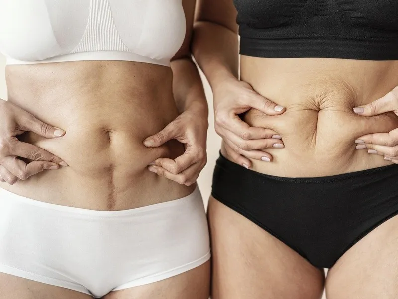 mit spalania tłuszczu masażem, płaski brzuch mity