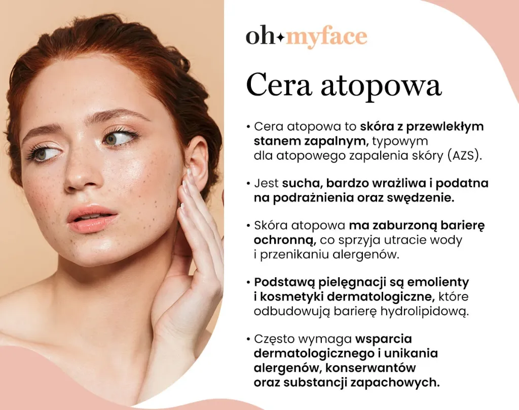 typy skóry infografika