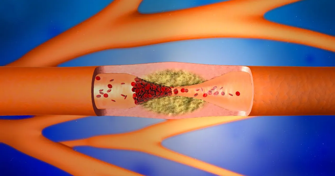 D-dimery co to jest badanie