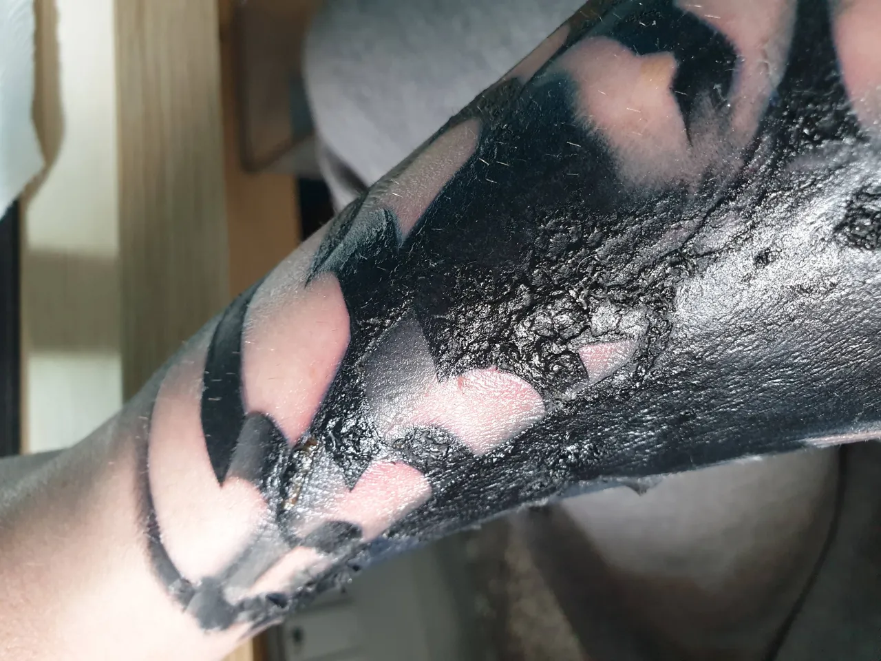 infekcja tatuażu objawy