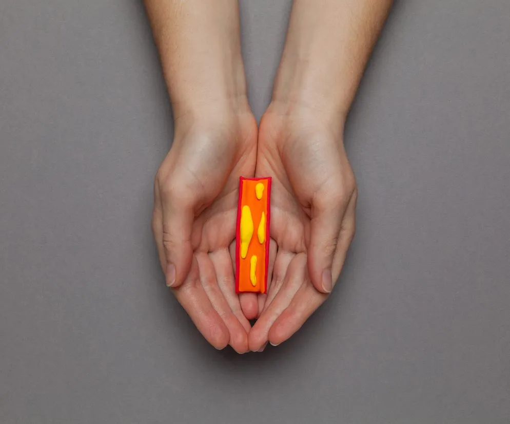 Objawy zakrzepicy ręki porównanie zdrowej i chorej