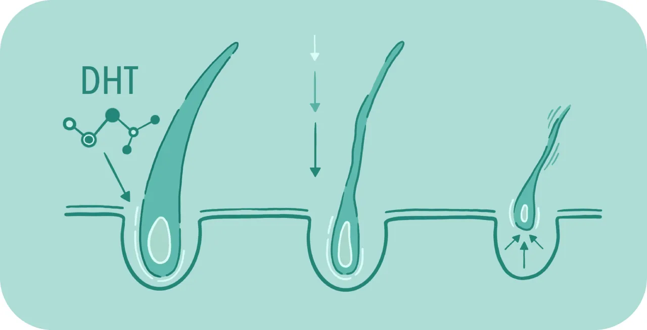 hormony testosteron dht wpływ na włosy