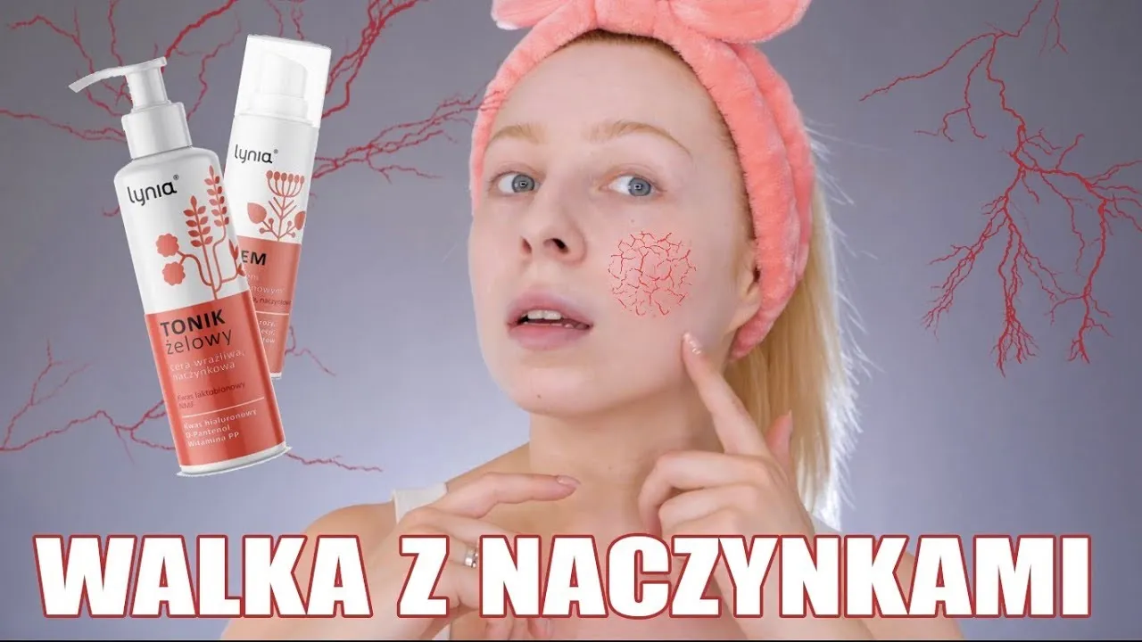 Zdjęcie Najlepsze kwasy do cery naczynkowej - jak je stosować bezpiecznie
