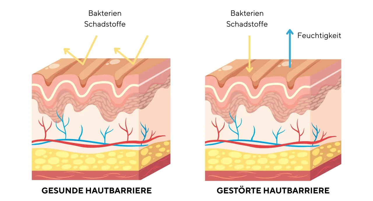 Gesunde Hautbarriere vs. gesch&auml;digte Hautbarriere