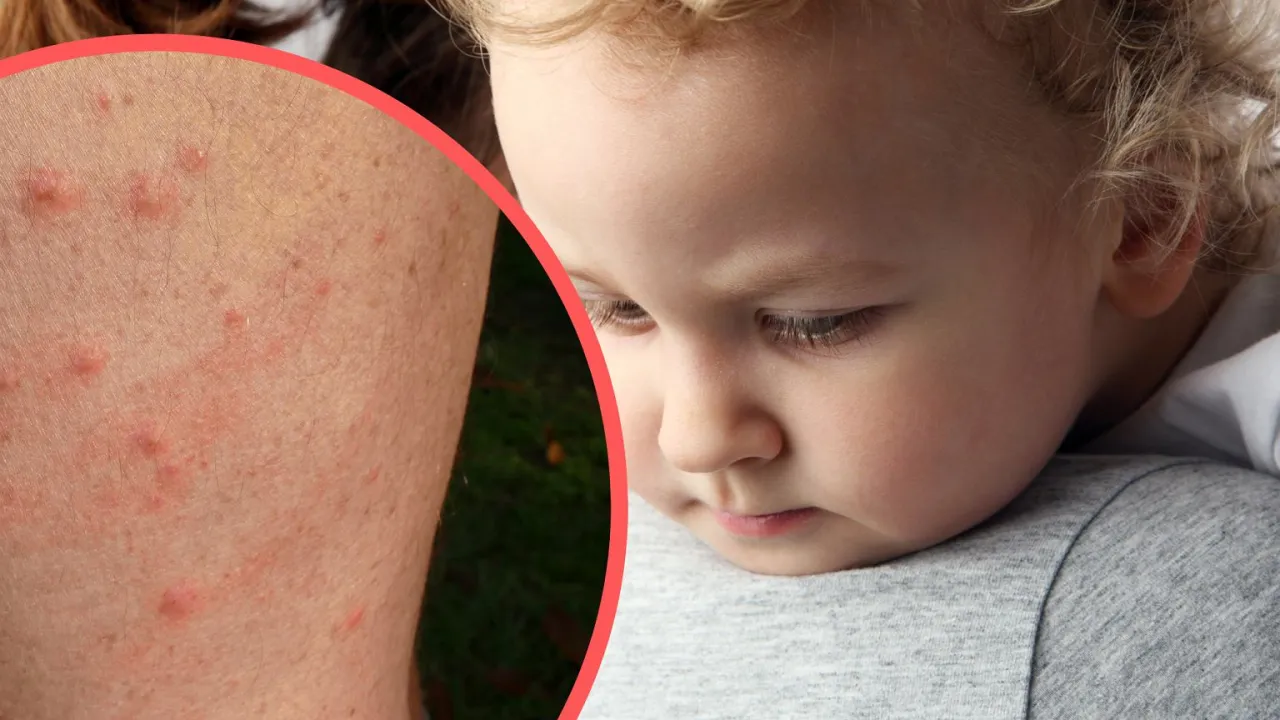 wysypka alergia na proszek niemowlę