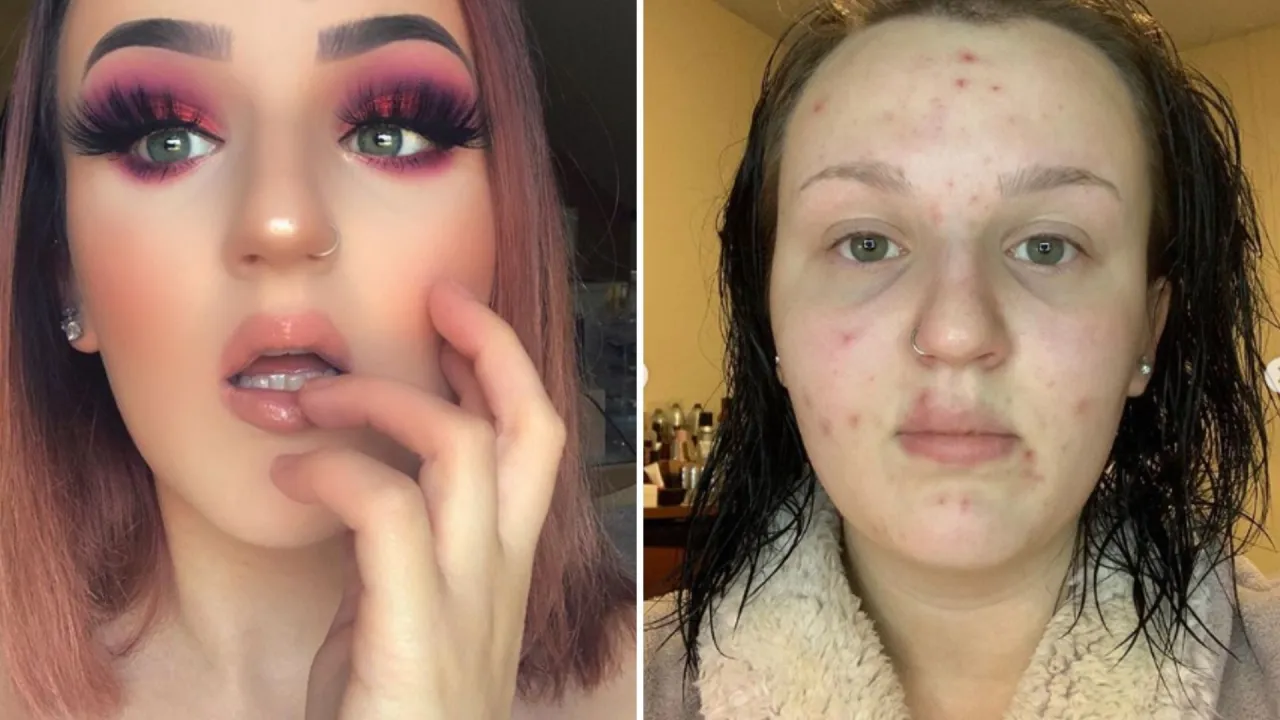 Przed i po: makijaż vs. skóra z niedoskonałościami. Dowiedz się, jak wysuszyć pryszcze i odzyskać gładką cerę.
