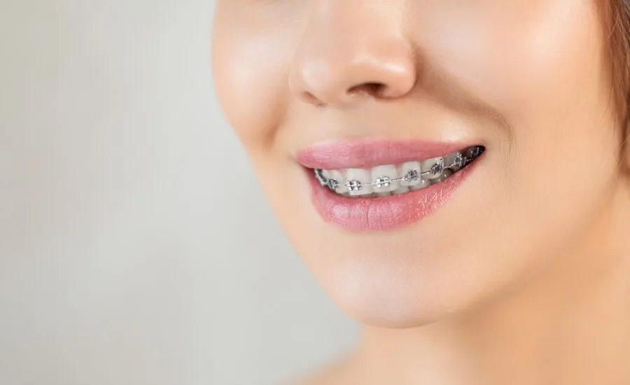 czynniki wpływające na czas leczenia ortodontycznego