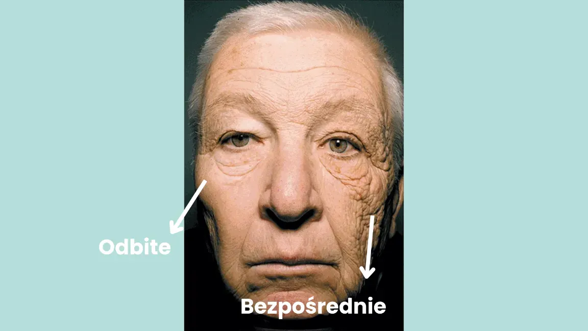 kobieta z filtrem spf na twarzy chroniąca się przed słońcem