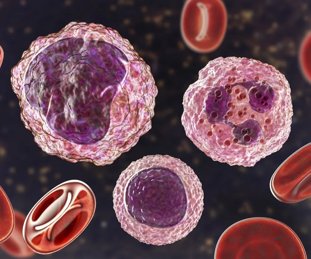 Infekcje wirusowe i bakteryjne przyczyny limfocytozy