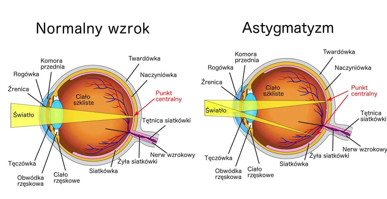 schemat osi astygmatyzmu 0-180 stopni