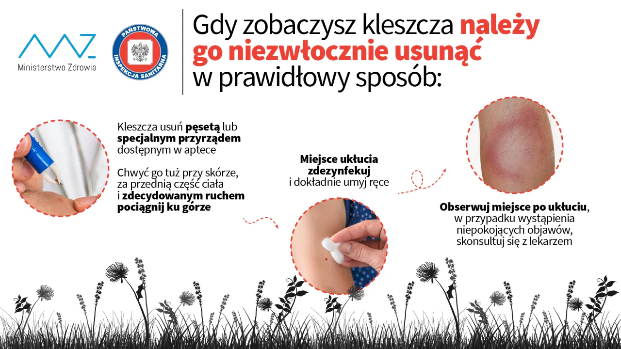 Jak prawidłowo usunąć kleszcza infografika