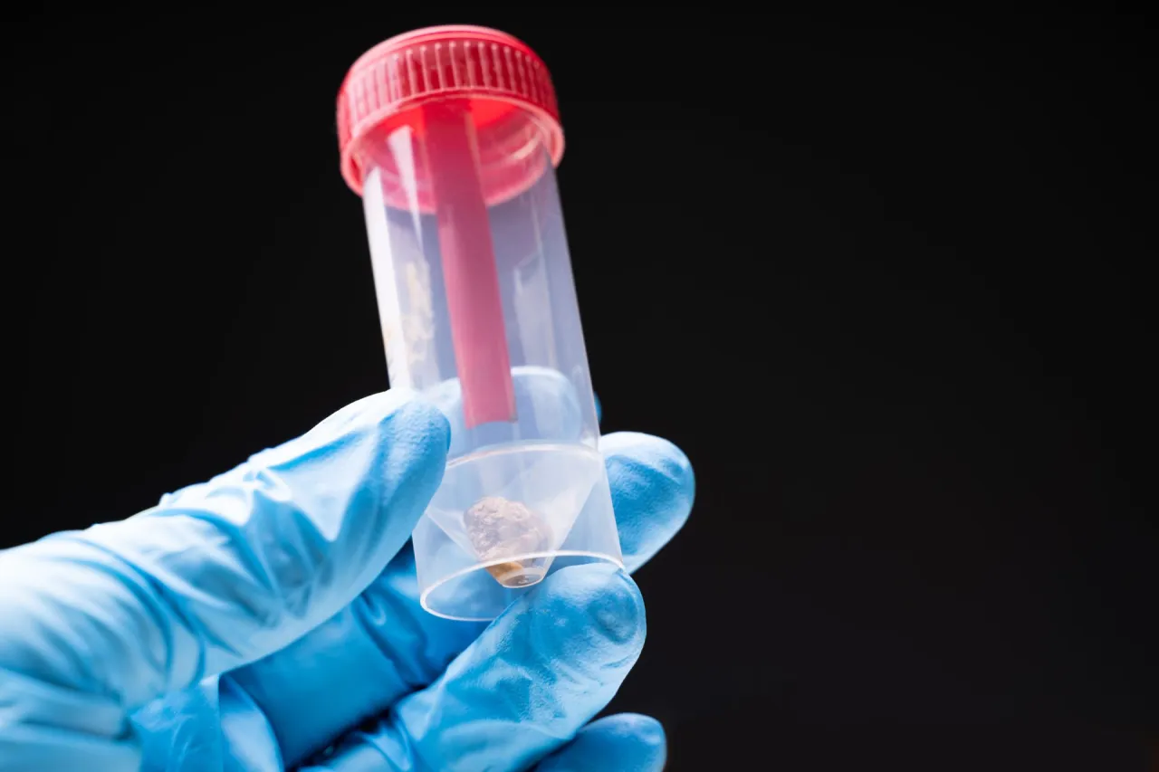 Pobieranie pr&oacute;bek kału do badań sanepidowskich